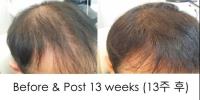 Hairgen Hair Loss Control Centre image 1